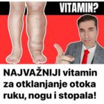 Najvazniji vitamini za otklanjanje otoka ruku,nogu i stopala!!!