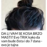 DA LI VAM SE KOSA BRZO MASTI? Evo TRIK kako da vam bude čista i do 7 dana – ovo je tajna