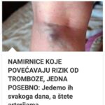 NAMIRNICE KOJE POVEĆAVAJU RIZIK OD TROMBOZE, JEDNA POSEBNO: Jedemo ih svakoga dana, a štete arterijama