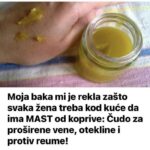 Moja baka mi je rekla zašto svaka žena treba kod kuće da ima MAST od koprive: Čudo za proširene vene, otekline i protiv reume!