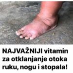 NAJVAŽNIJI vitamin za 0tklanjanje 0toka ruku, nogu i stopala!