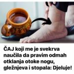 ČAJ koji me je svekrva naučila da pravim odmah otklanja otoke nogu, gležnjeva i stopala: Djeluje!