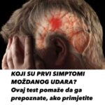 KOJI SU PRVI SIMPTOMI MOŽDANOG UDARA? Ovaj test pomaže da ga prepoznate, ako primjetite ovo..