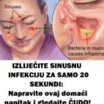 IZLIJEČITE SINUSNU INFEKCIJU ZA SAM0 20 SEKUNDI: Napravite ovaj domaći napitak i gledajte ČUDO! (RECEPT)