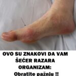 OVO SU ZNAKOVI DA VAM ŠEĆER RAZARA ORGANIZAM: Obratite pažnju