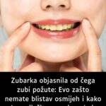 Zubarka objasnila od čega zubi požute: Evo zašto nemate blistav osmijeh