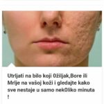 Utrljati na bilo koji 0žiljak,Bore ili Mrlje na vašoj koži i gledajte kako sve nestaje u samo nek0liko minuta !