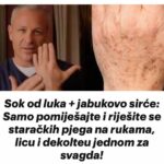 Sok od luka + jabukovo sirće: Samo pomiješajte i riješite se staračkih pjega na rukama, licu i dekolteu jednom za svagda!
