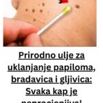 Prirodna njega kože: Kako prirodnim uljima i biljkama podržati uklanjanje papiloma, bradavica i gljivica