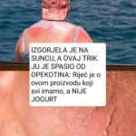 IZGORJELA JE NA SUNCU, A OVAJ TRIK JU JE SPASIO OD OPEKOTINA: Riječ je o ovom proizvodu koji svi imamo, a NIJE JOGURT