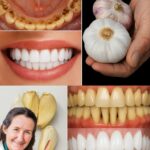 🦷✨ TAJNA KOJU STOMATOLOZI NE ŽELE OTKRITI: UKLONITE KAMENAC I IZBIJELITE ZUBE ZA SAMO 2 MINUTE!** 😲