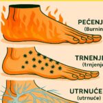 Simptomi na stopalima koje ne smijete ignorisati 👣