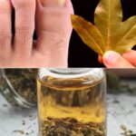 Trenutačno eliminiše gljivice na noktima! Nemojte više trošiti novac u apoteci!