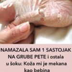 Koža mi je mekana kao bebina, TRIK KOJI ME SPASIO RUŽNIH I ISPUCALIH PETA