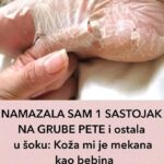 NAMAZALA SAM 1 SASTOJAK NA GRUBE PETE i ostala u šoku: Koža mi je mekana kao bebina, TRIK KOJI ME SPASIO RUŽNIH I ISPUCALIH PETA