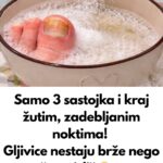 Samo 3 sastojka za žute i zadebljale nokte! GLJIVICE NA NOKTIMA KAO RUKOM ODNESENE…
