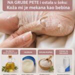 NAMAZALA SAM 1 SASTOJAK NA GRUBE PETE i ostala u šoku: Koža mi je mekana kao bebina, TRIK KOJI ME SPASIO RUŽNIH I ISPUCALIH PETA
