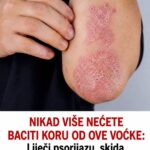 Nikad više nećete baciti koru od ove voćke: liječI psorijazu, skida bradavice I izbjeljuje zube